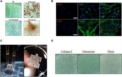 Tailoring the secretome composition of mesenchymal stem cells to augment specific functions of epidermal regeneration: an in vitro diabetic model
